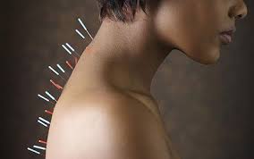 Acupuncture for Hypothyroid Conditions