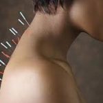 Acupuncture for Hypothyroid conditions