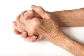 Treatments for Rheumatoid Arthritis 