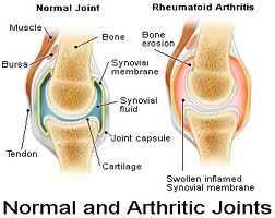 Herbal Inflammation Pain Relief Formula