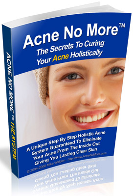 cure acne naturally