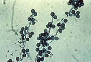 What causes Candida Albicans