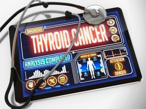 Thyroid Cancer Symptoms,