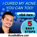 cure acne naturally